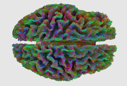 Hybrid Interactions for Neurosurgical Planning